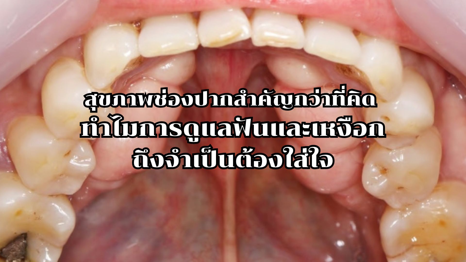 คลินิกทำฟัน